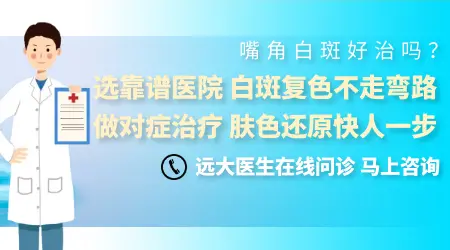 嘴角白癜风多久能治好