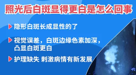 照了308激光以后感觉白斑更白了