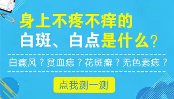 儿童脸颊有几个白斑是什么皮肤病