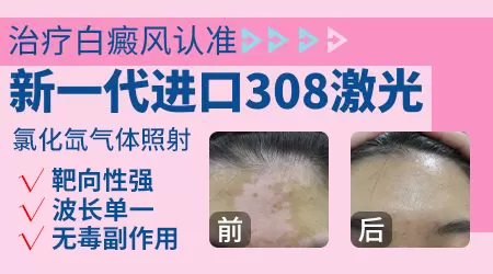 308激光比其他光治白癜风的优势