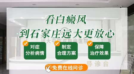 石家庄哪家医院治白癜风技术好