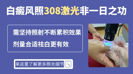 一块白斑308激光几次能治好