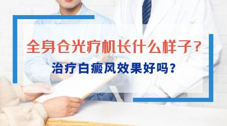 白癜风全身光疗一次多少钱