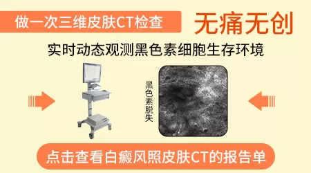 河北省哪些医院有三维皮肤ct