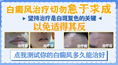 白癜风搓澡能搓红吗