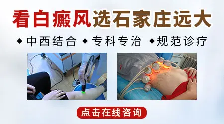 治白癜风专科医院排名榜