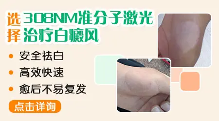 308激光照白斑照了一年半还要照吗