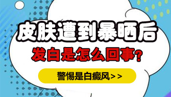 脸部暴晒后出现白斑怎么回事