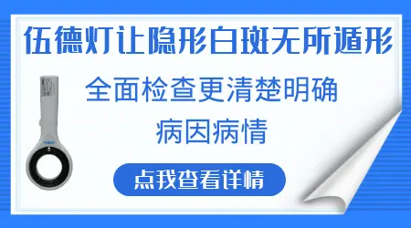 白斑是一下就长出来吗 白癜风长什么样