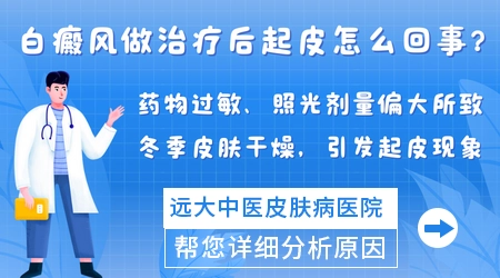 308激光白癜风部位起皮能撕吗