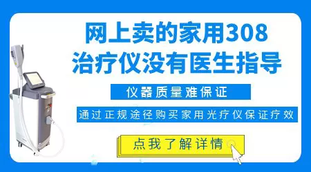 网上白癜风家用治疗仪哪个牌子靠谱