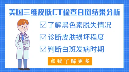 检查白斑是不是白癜风皮肤ct要做吗