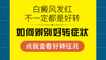 手上有白癜风照了308皮肤红了是好还是不好