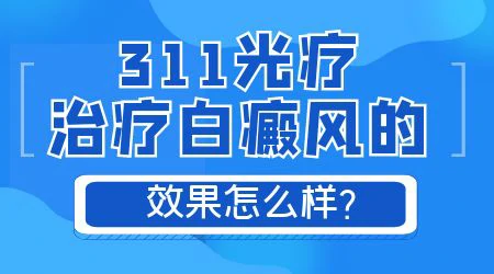 紫外线照射白癜风一周几次合适