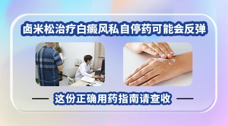 卤米松停用白斑会大面积扩散吗