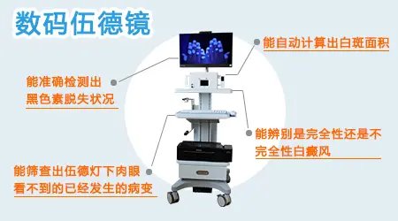 白癜风皮损面积怎么算