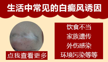 新生儿腿缝发白为什么