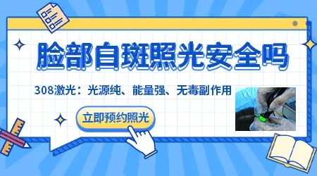 面部白癜风照射308激光效果怎么样