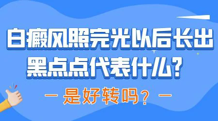 白癜风照完光后皮肤长黑点是好转吗