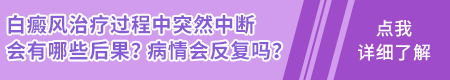 白癜风没有完全好就中断治疗白斑会扩散吗