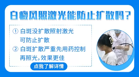 308治白癜风一边好转一边新发白斑