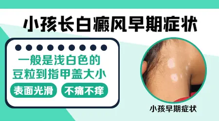 新生儿额头一块皮肤发白图