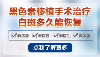 白癜风的表皮移植多长时间能够恢复