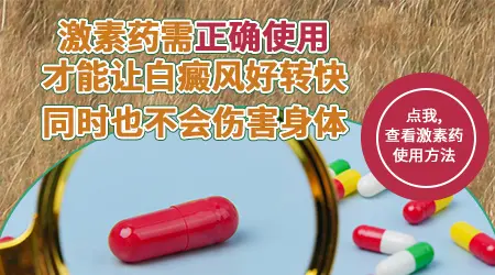 发展快的白癜风可以用激素药吗