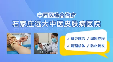 肛门周围白斑做美国308准分子能好吗