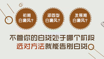 白癜风就剩下一个小点总是不好该咋办