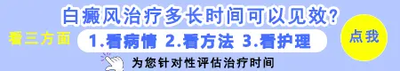 白癜风刚发现就开始治什么时候能治好