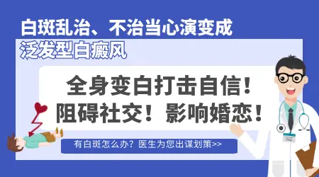 局限型白癜风不治能不能行