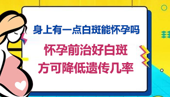 白癜风扩散的时候怀孕了会遗传给宝宝吗