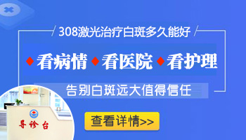 美国进口的308激光治疗白斑多久有效果