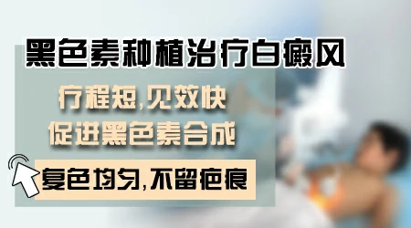 黑色素种植和308激光治疗白癜风效果对比