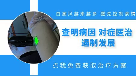 身上白点越来越多是怎么回事