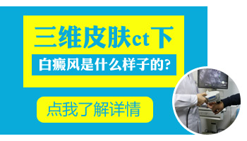 白斑是不是白癜风做伍德灯检查能查出来吗