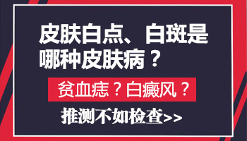 肚子上和手上从小就有白点怎么回事