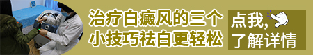 白癜风全身变白 身上好多白癜风怎么治