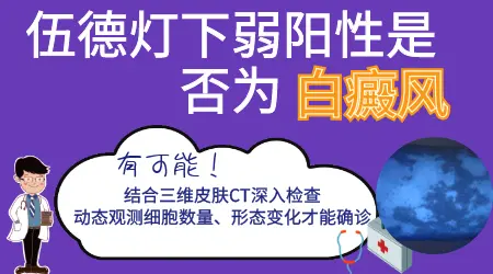 伍德灯下弱阳性白斑是不是白癜风