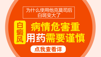 白癜风如果不治疗到底会怎么样