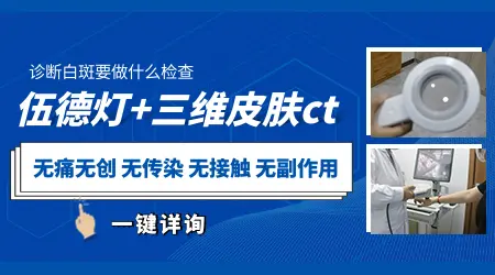 身上有一点白色的斑块 2024石家庄白斑收费标准