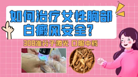 女孩胸前有白癜风该怎么办