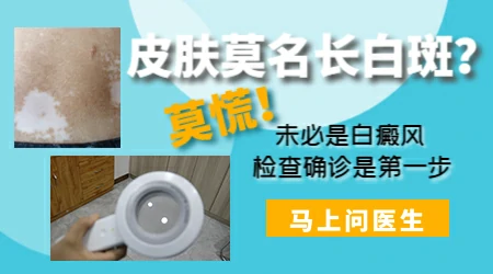 发际线出现浅色的白斑是什么