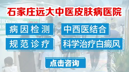 喝药抹药治白癜风一个月大概需要多少钱