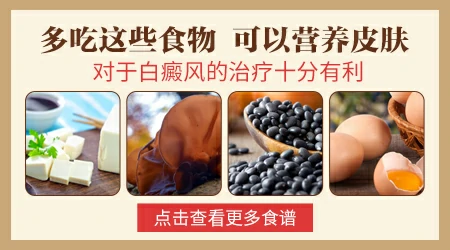 吃哪些食物可以治疗白斑