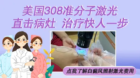 隐性白斑能照308激光吗