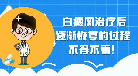 根据白斑颜色判断白癜风症状