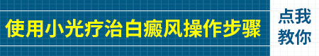 自己在家照白癜风距离皮肤多远合适