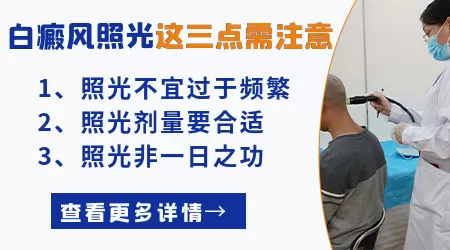 石家庄308激光进口与国产效果对比